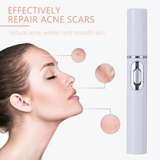 Blue Light Therapy Acne Laser Pen Soft Scar Wrinkle Removal Treatment Device Skin Care Beauty Equipment - Sunny Side Store