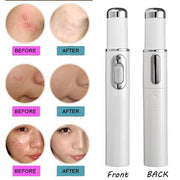 Blue Light Therapy Acne Laser Pen Soft Scar Wrinkle Removal Treatment Device Skin Care Beauty Equipment - Sunny Side Store