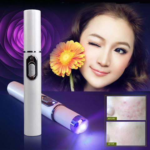 Blue Light Therapy Acne Laser Pen Soft Scar Wrinkle Removal Treatment Device Skin Care Beauty Equipment - Sunny Side Store