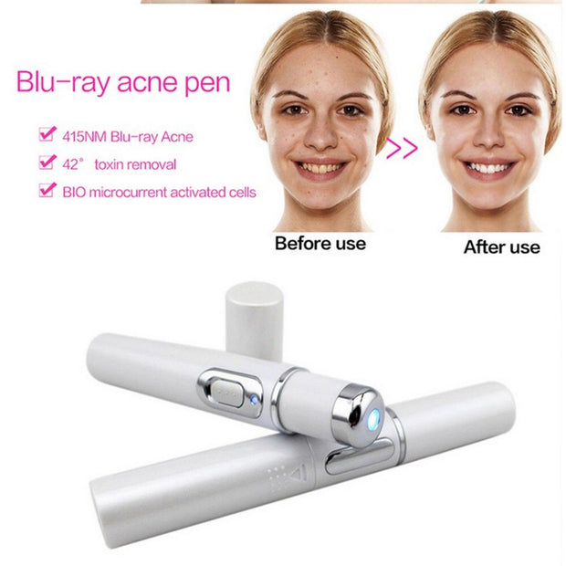 Blue Light Therapy Acne Laser Pen Soft Scar Wrinkle Removal Treatment Device Skin Care Beauty Equipment - Sunny Side Store