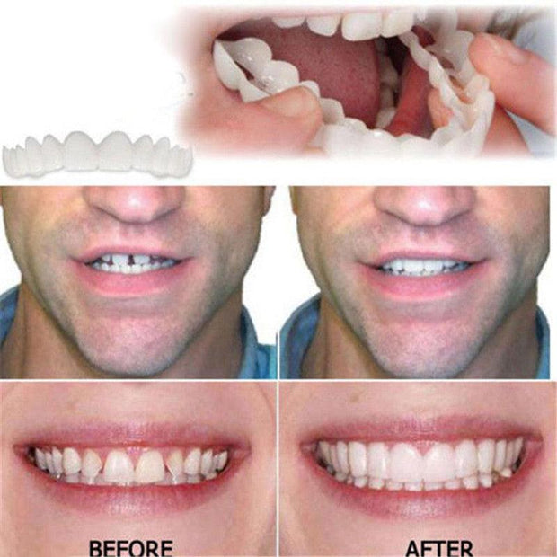 Whitening Braces Simulation Teeth Denture Brace - Sunny Side Store