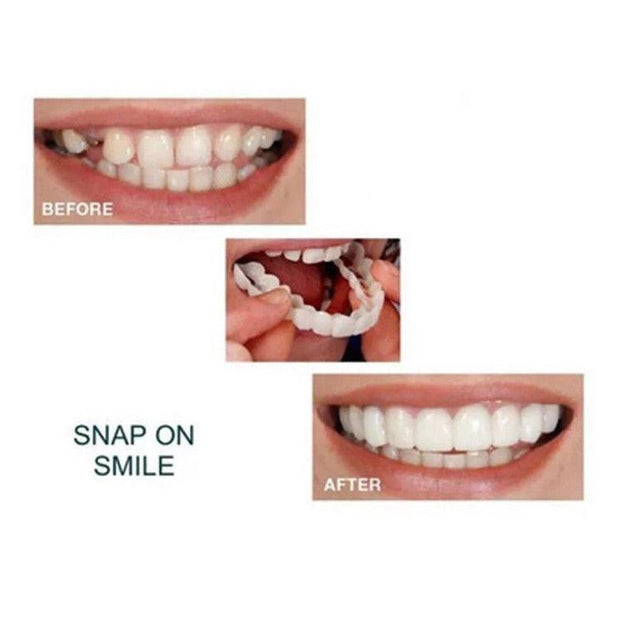 Whitening Braces Simulation Teeth Denture Brace - Sunny Side Store