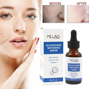 30ml Glutathione Lightening Serum Alpha Arbutin Vitamin C & B3 Collagen Reducing Dark Spots Blemishes Serum S2 - Sunny Side Store Small Elk Store  22.05